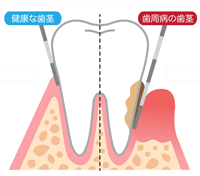 歯茎の健康